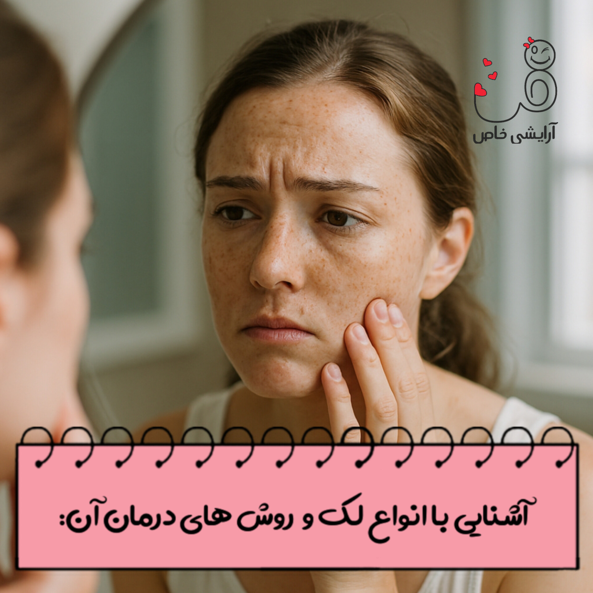 درمان لک صورت